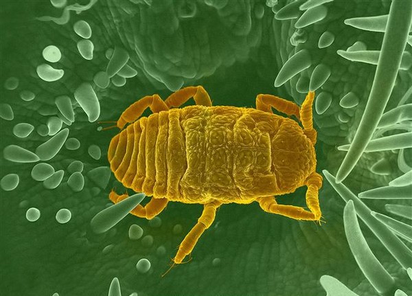 电子显微镜下的根瘤蚜虫（Phylloxera），来源：FEI